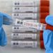 Mucho más que lo dicho por Salud Pública. CORONAVIRUS