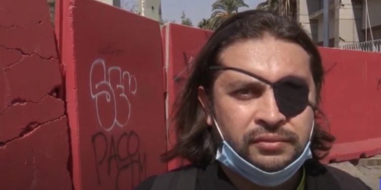 Un ojo de la cara, el costo más alto en un año de protestas en Chile