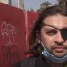 Un ojo de la cara, el costo más alto en un año de protestas en Chile
