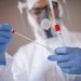 Salud Pública reporta 140 nuevos casos de coronavirus, y 5 fallecidos en últimas 24 horas