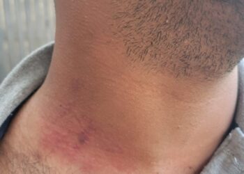 Migración aclara nacional haitiano que agredió agente  no recibió maltrato en Jarabacoa