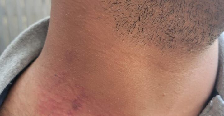 Migración aclara nacional haitiano que agredió agente no recibió maltrato en Jarabacoa