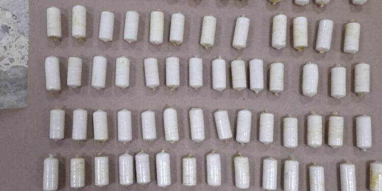 Detienen Dominicano con más de un kilo de Cocaína en el estómago