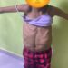 Madre desesperada pide ayuda para costear estudios y tratamiento médico de su hija menor de edad