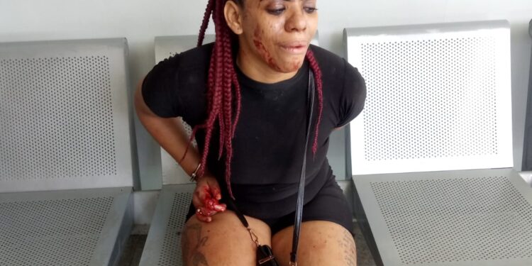 Mujer ultima de estocada a su pareja y lo lleva por emergencia a Clínica Cruz Jiminian