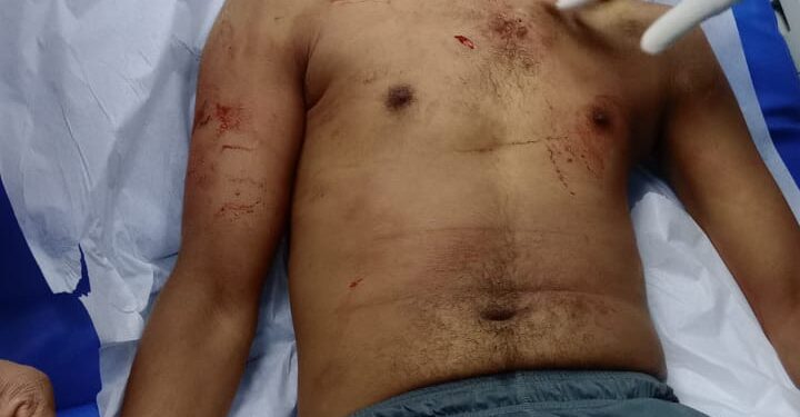 Asesinan joven de estocada en el pecho en sector Enrriquillo de Herrera