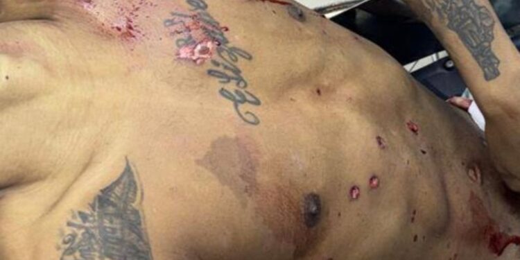 Cae abatido en Los Pinos de Guachupita presunto delincuente perseguido por muerte de raso policial y herir acompañante en asalto en Las Ciénaga